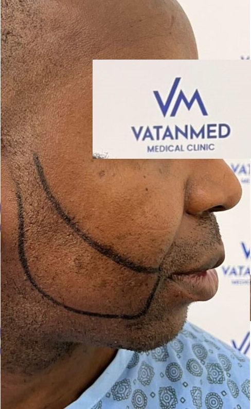 https://www.vatanmed.co.ke/wp-content/uploads/2023/09/BEARD2.jpeg